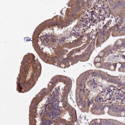 Integrin beta 4/CD104 Antibody, Novus Biologicals:Antibodies:Primary Antibodies